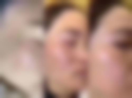 台州黄岩昊阳整形医院价格表（仅供参考）