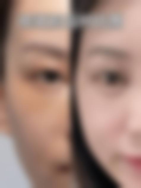 韩国爱特乐皮肤整容外科价格表（仅供参考）