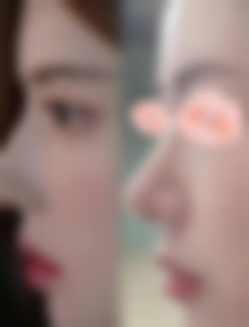 玉溪合励整形医院核心项目