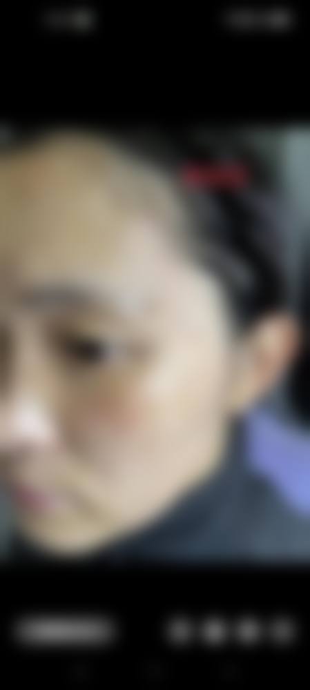 汉中市中医医院皮肤科实例参考