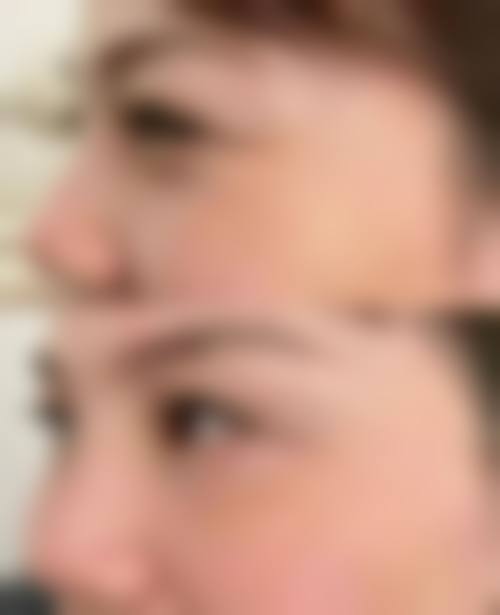 崔红娥患者评价