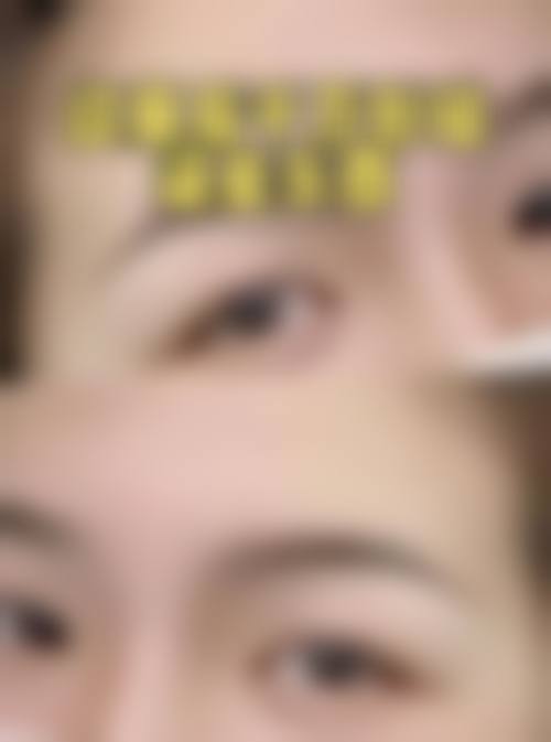 安溪君澜星慧整形医院价格表（仅供参考）