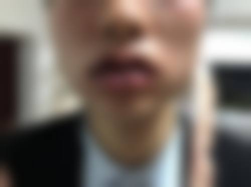 丽江东美医疗美容门诊部怎么预约?