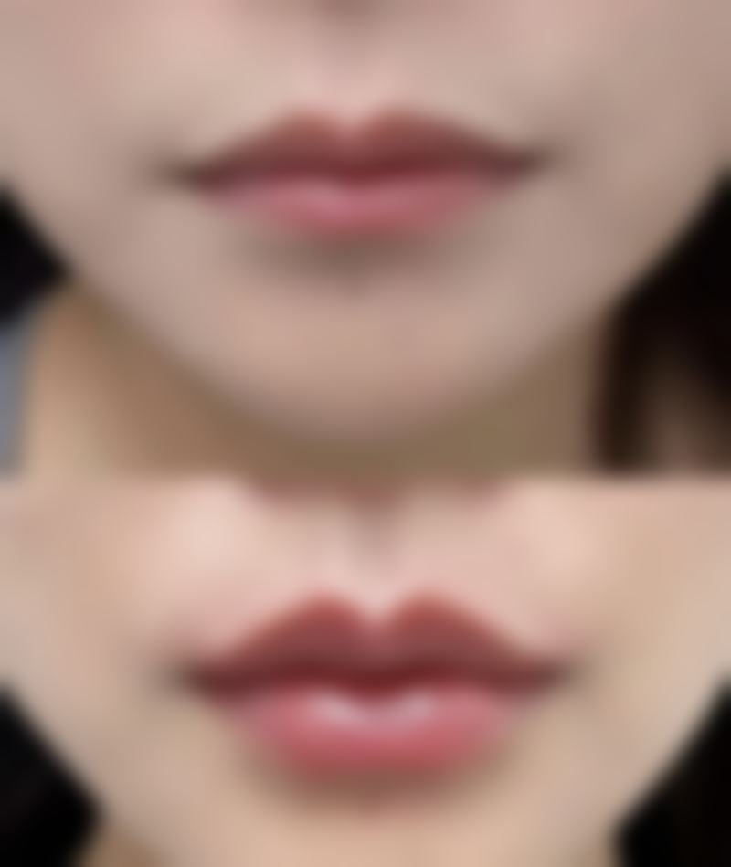 玉溪合励整形医院正规吗?看资质