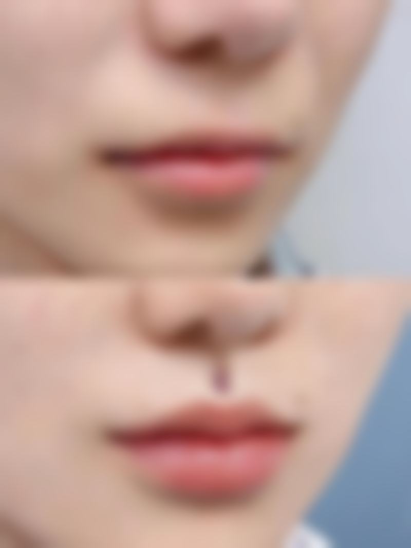 盐城响水莳月时光整形医院怎么预约？