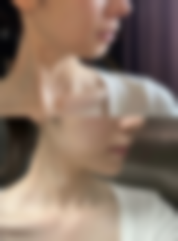 韩国韩美人皮肤科医院价格表（仅供参考）