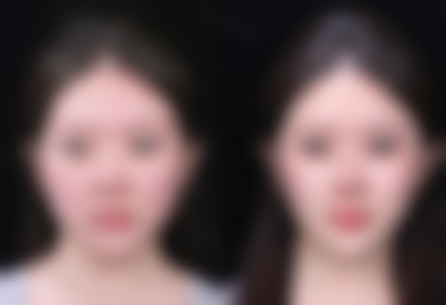 台州黄岩昊阳整形医院怎么预约？