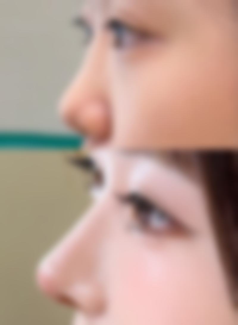 崔红娥预约方式