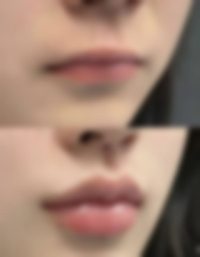 珠海大懒虫医疗美容诊所实例参考