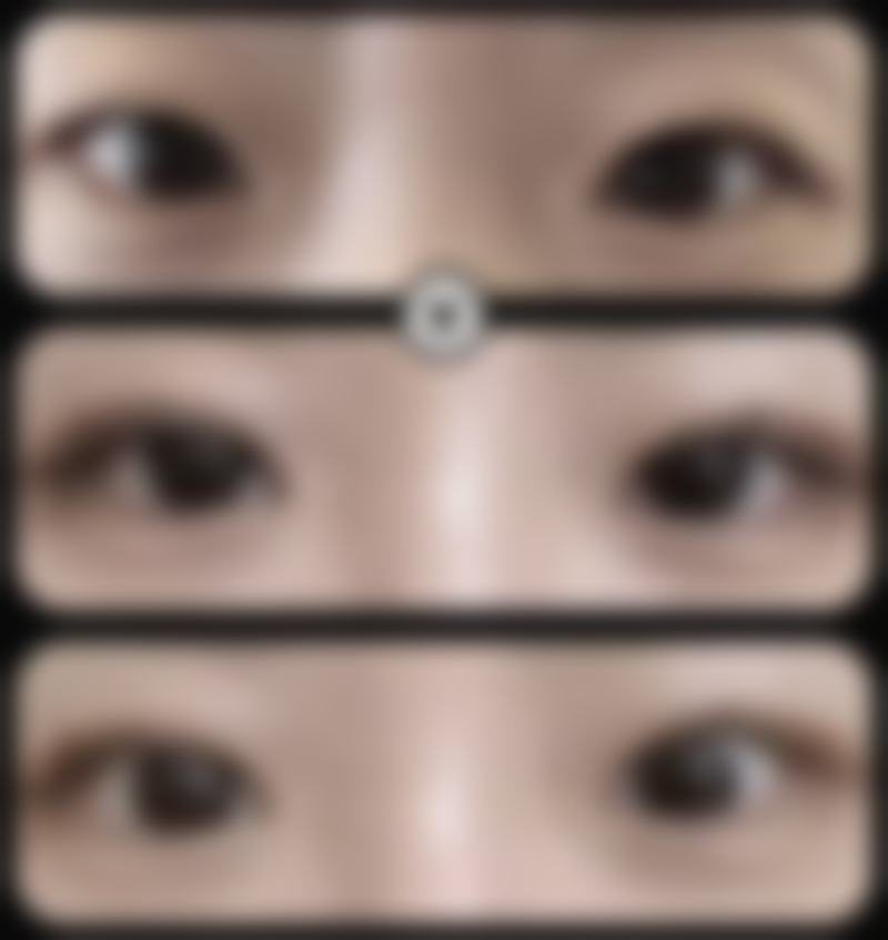 兰州颜姿整形医院实例参考