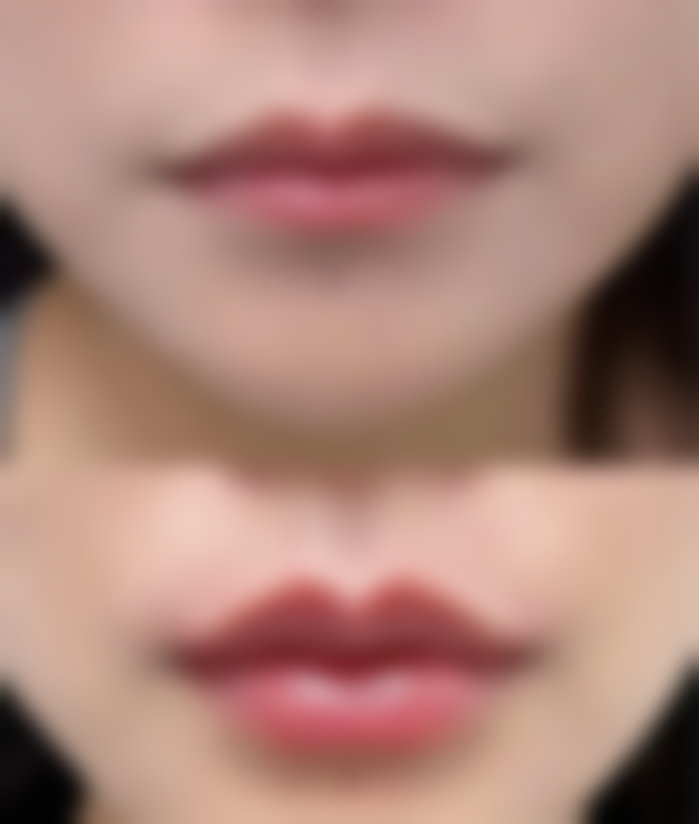 贺州广济格美整形医院实例参考