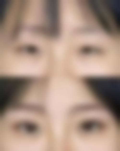 张掖颜艺美整形医院怎么预约？