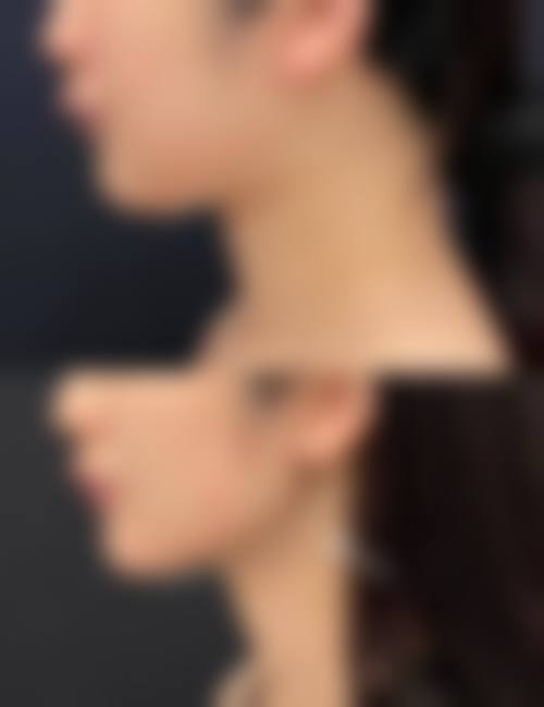 丽江吴氏滨滨医疗美容诊所实例参考