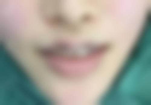 宜春袁州艾莱芙医疗美容整形医院实例参考