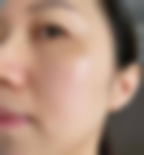 沈阳童颜医疗美容门诊部实例参考