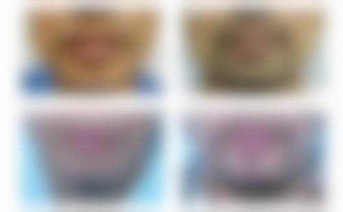 福州千和医疗美容门诊部怎么预约?