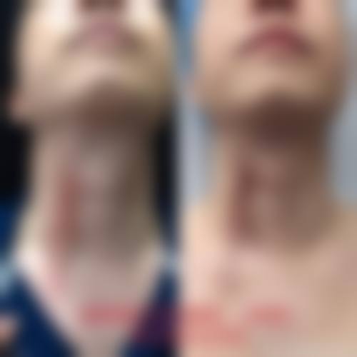 靳雪义擅长项目列表