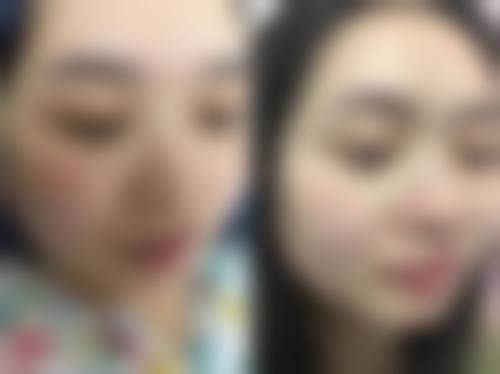 焦作市人民医院整形外科价格表(仅供参考)