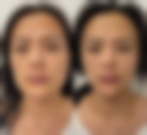 大连悦己医疗美容诊所怎么预约？