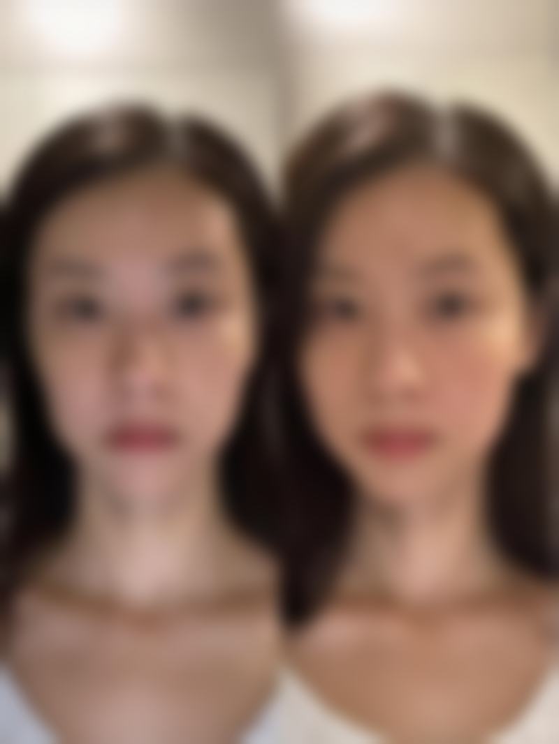 扬州邗江苏忆医疗美容诊所价格表（仅供参考）