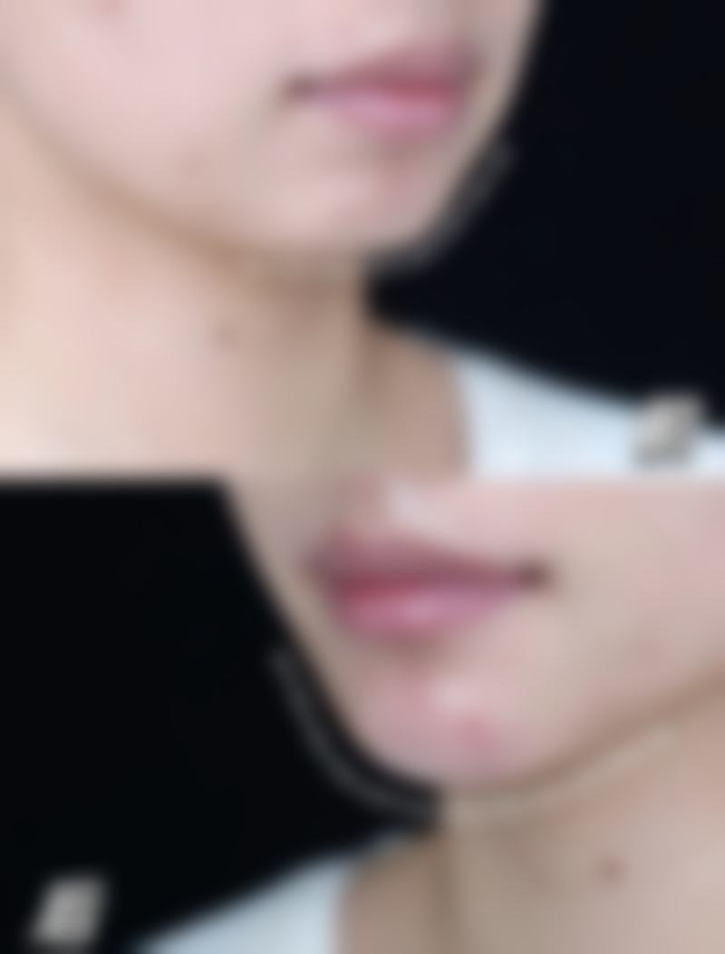 宜春袁州艾莱芙医疗美容整形医院正规吗?看资质