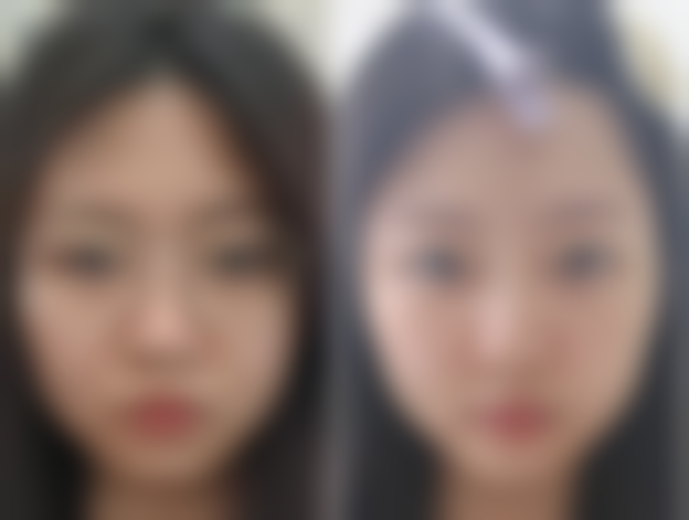 天津河东菲丝澜医学美容整形医院价格表(仅供参考)