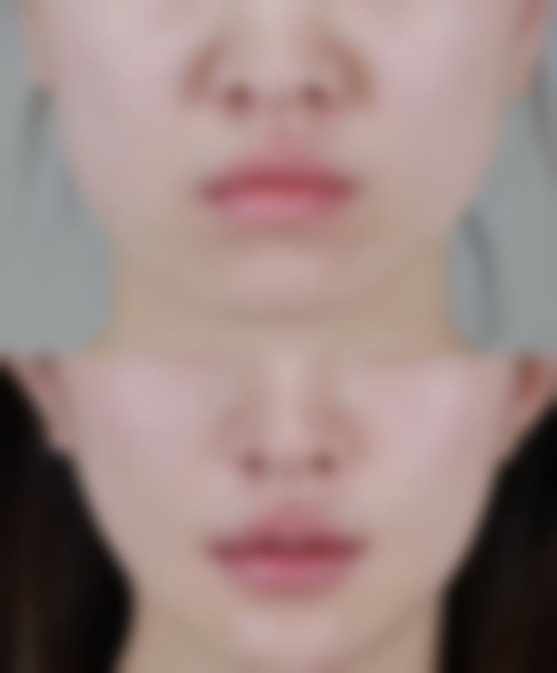 沈阳孙常青医疗美容诊所实例参考