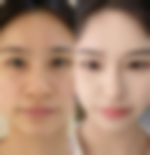 宜春袁州艾莱芙医疗美容整形医院核心项目