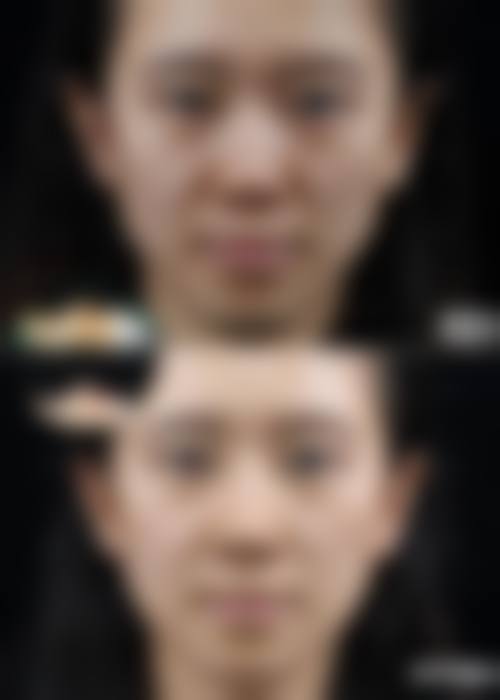 大庆超龙整形医疗美容医院正规吗？看资质