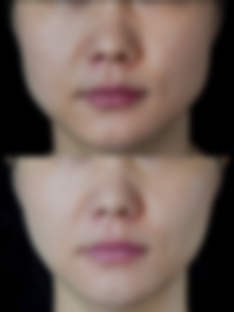 唐山市星范医疗美容门诊部价格表（仅供参考）