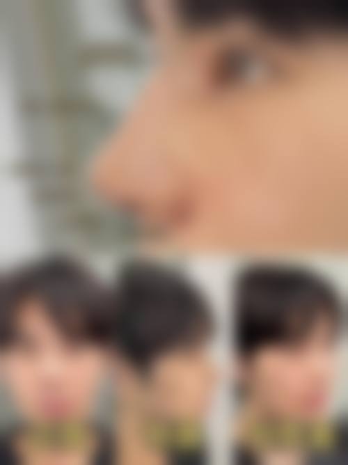 邯郸雅乾医疗美容整形医院实例参考