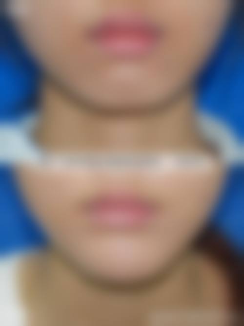 通辽乌宇新医疗美容门诊部怎么预约?