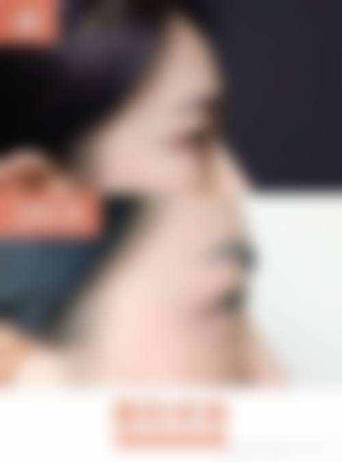 邯郸雅乾医疗美容整形医院价格参考(仅供参考)