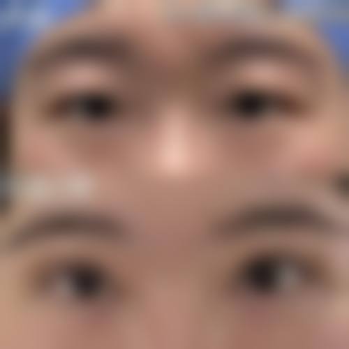 邯郸天画整形实例参考