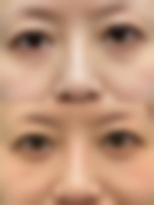 南宁慧小美整形医院核心项目