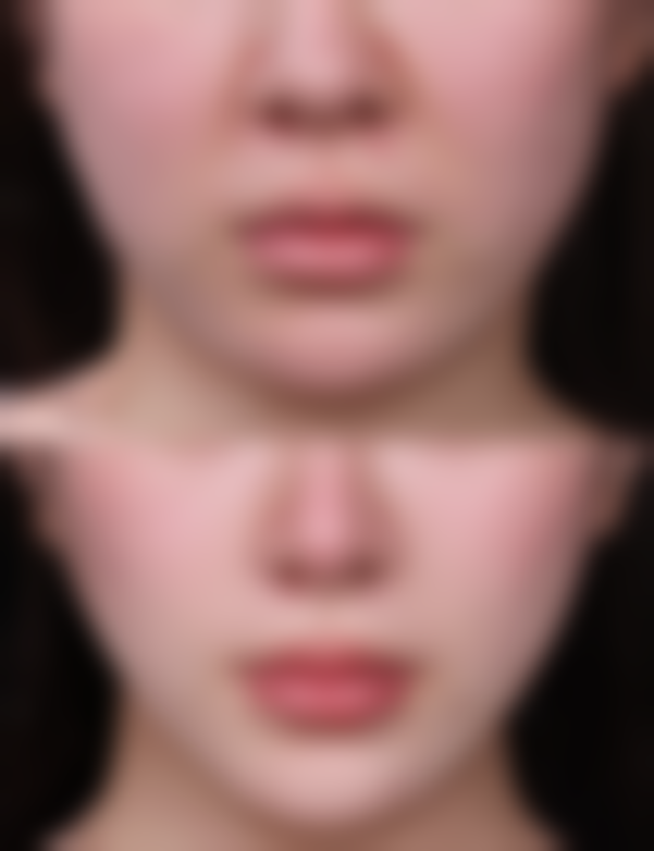 南宁慧小美整形医院价格表（仅供参考）