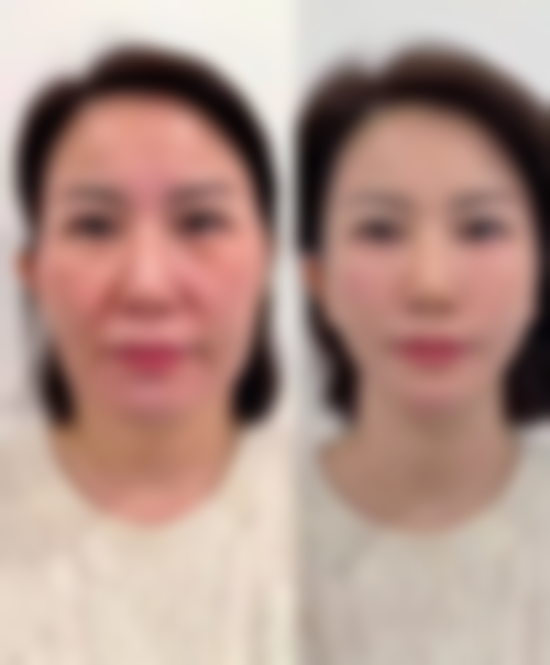 长沙姿尔美整形医疗美容门诊部正规吗？看资质