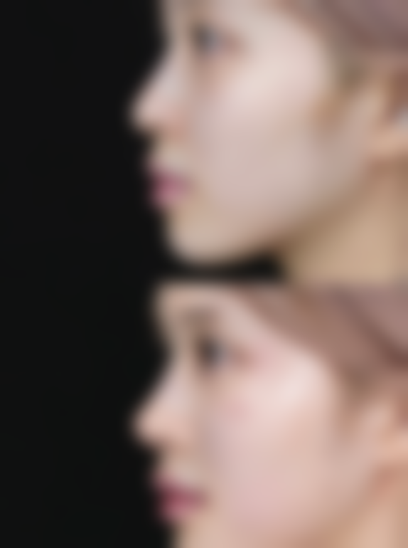 王馨艺擅长项目列表