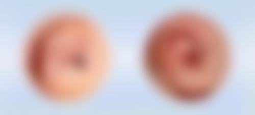 西安市人民医院(医疗美容科)怎么预约？