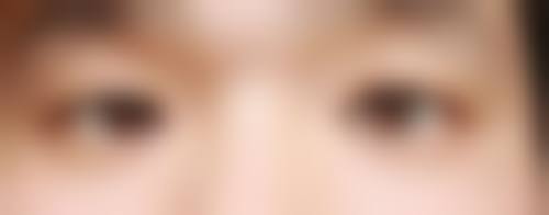 青岛美诺医学美容医院怎么预约？