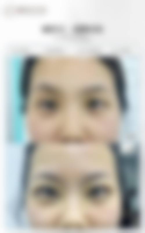 济南美宜修整形医疗美容诊所价格表（仅供参考）