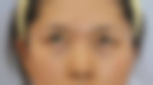 香河元美整形医院正规吗？看资质