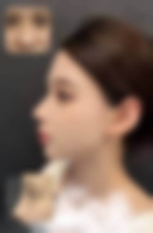 新疆王蛟医疗整形美容实例参考