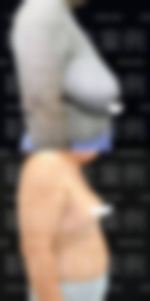 丽江美柏瑞医疗美容医院怎么预约？