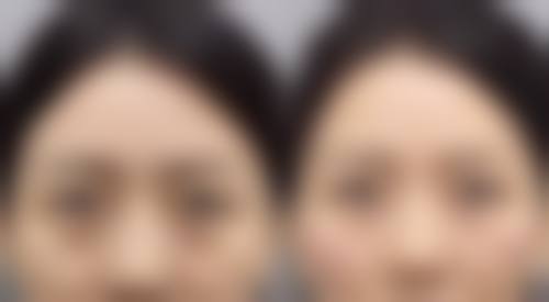 深圳美客华美医疗美容门诊部价格参考(仅供参考)