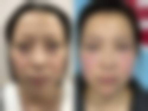 郑州同乐医疗美容怎么预约?