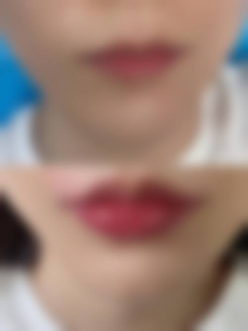 东莞格美雅韵医疗美容门诊部怎么预约？