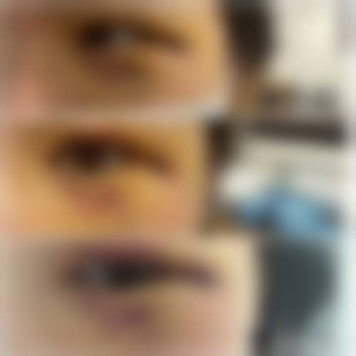 广西 南宁英和医疗美容门诊核心项目