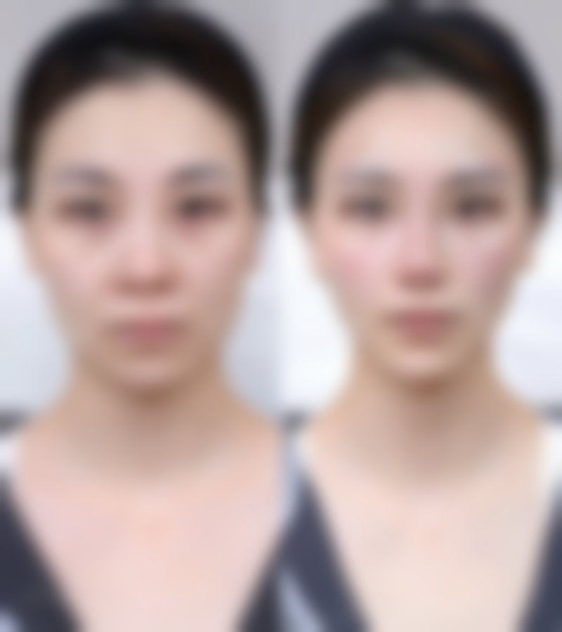 深圳美客华美医疗美容门诊部核心项目