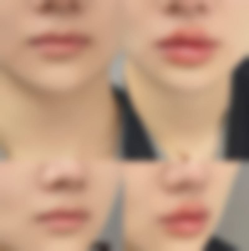 东莞格美雅韵医疗美容门诊部正规吗？看资质